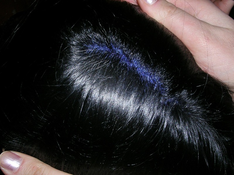 hair