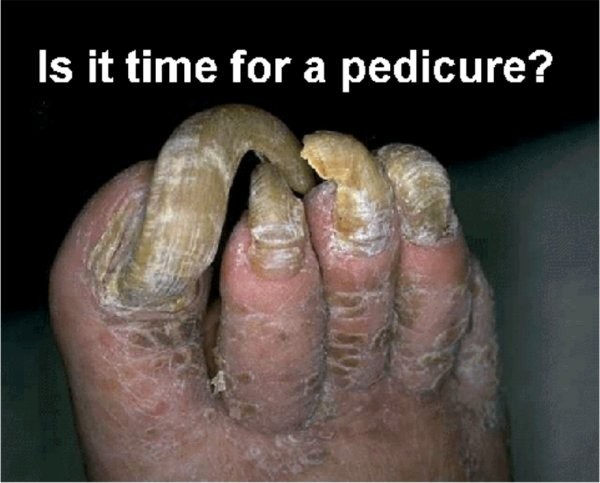 Pedicure?No grazie...